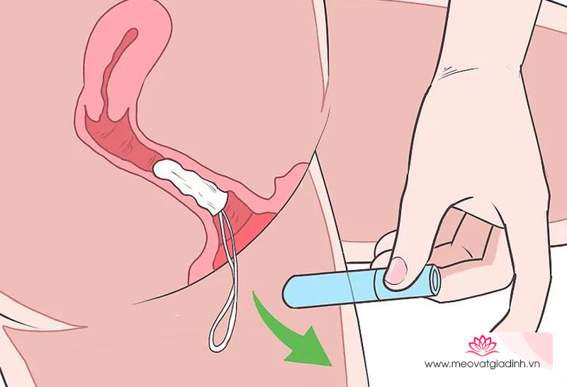 Hướng dẫn sử dụng tampon đúng cách và an toàn trong ngày đèn đỏ