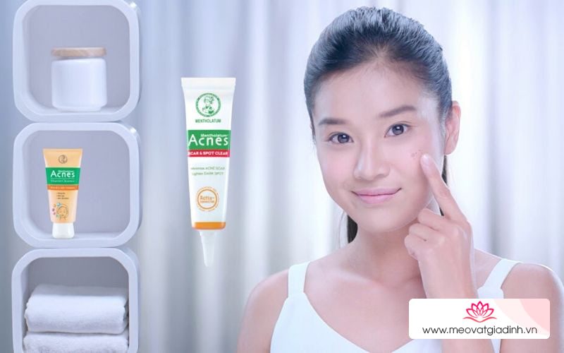 Kem trị mụn Acnes có tốt không