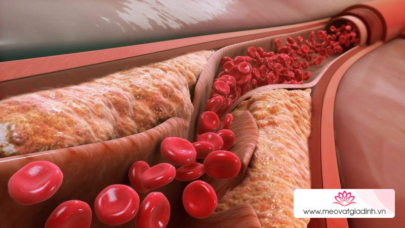 Dầu hướng dương làm giảm cholesterol xấu
