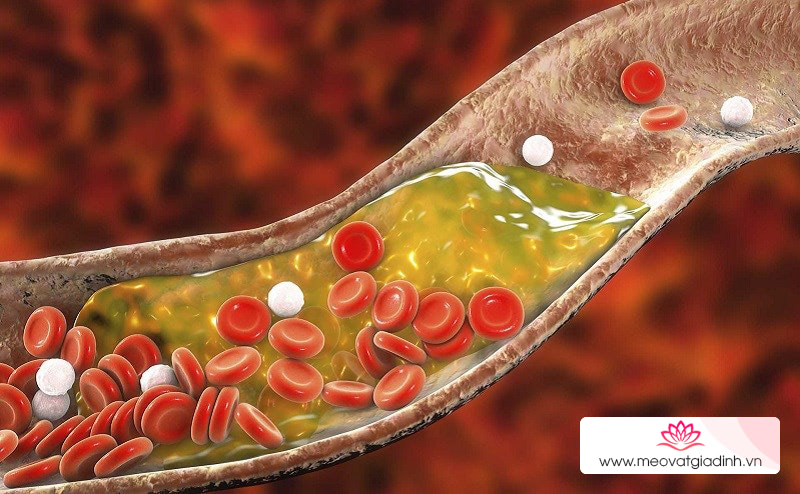 Đậu tằm giúp giảm lượng cholesterol