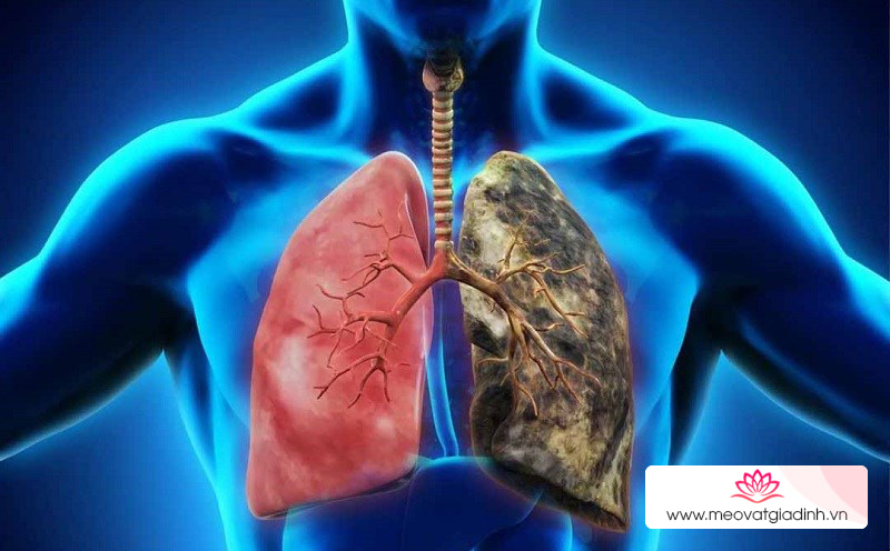Kỷ tử cải thiện sức khỏe phổi