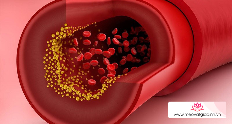 Nước cốt dừa cải thiện lượng cholesterol