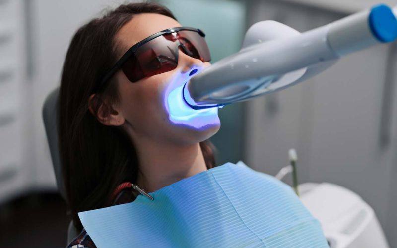 Kỹ thuật tẩy trắng răng bằng laser được nhiều chuyên gia nha khoa khuyên dùng